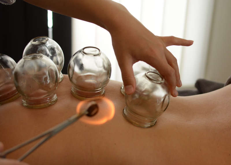 cupping