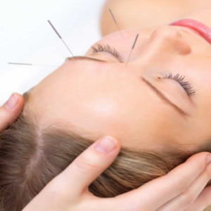 ansikts akupunktur